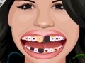 Igra Selena Gomez Perfect Teeth 