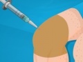 Igra Operate Now: Knee Surgery