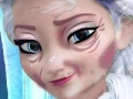 Igra Elsa Rejuvenation