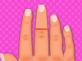 Igra Finger surgery