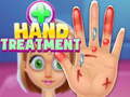 Igra Hand Treatment